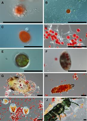 Alpine Snow Algae Microbiome Diversity in the Coast Range of British Columbia